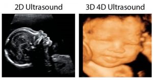 2d-3d-4d-hd-live-ultrasound-banner